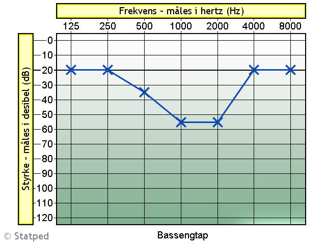 Audiogram med blå graf. 