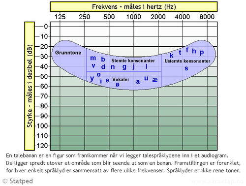 Illustrasjon av en talebanan i et diagram.