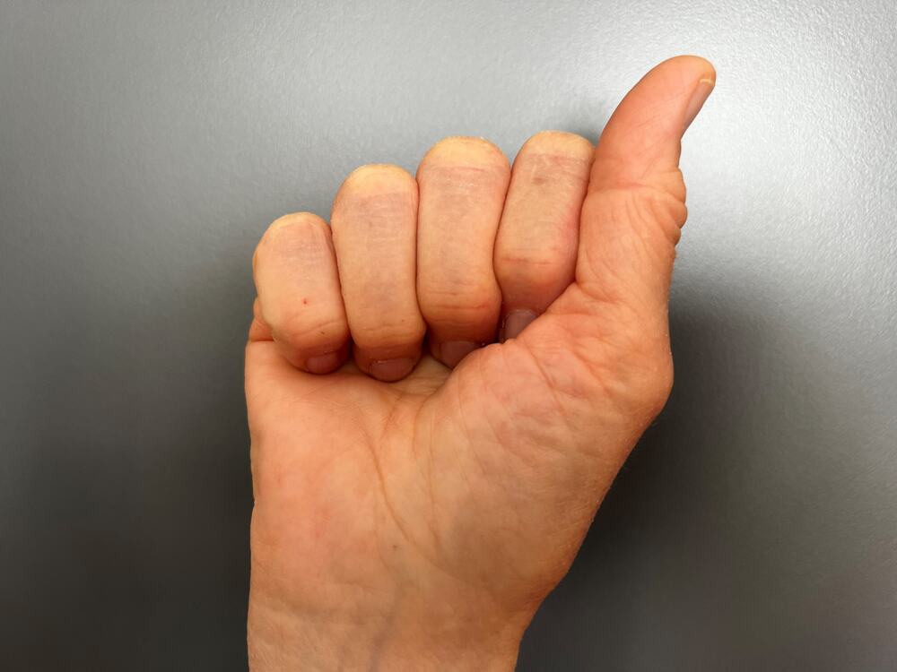 Hånd som er formet som en tegnspråk A