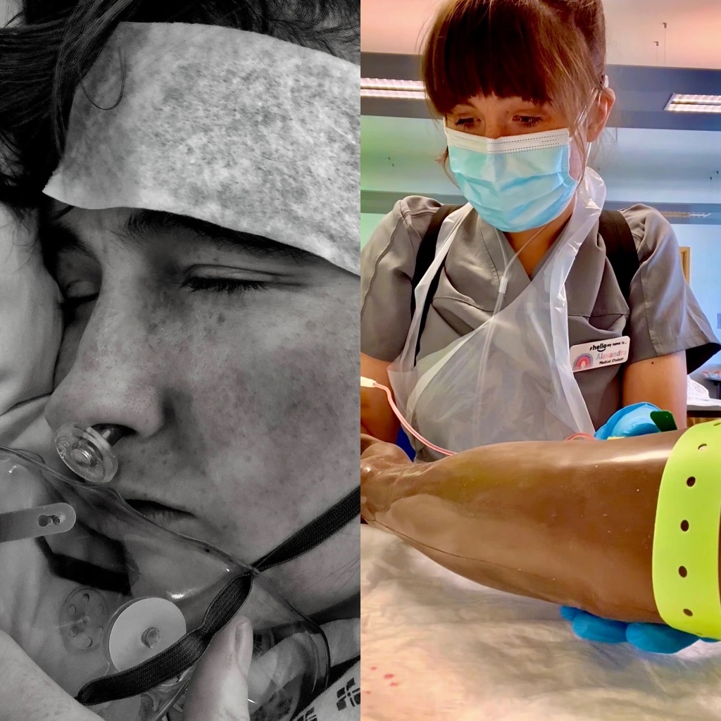 To bilder satt ved siden av hverandre. Svart-hvitt bilde til venstre som viser en kvinne liggende med slange i nesen og til høyre bilde av kvinne i legeuniform som øver på behandling av en arm.